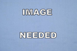 [Image Needed ]